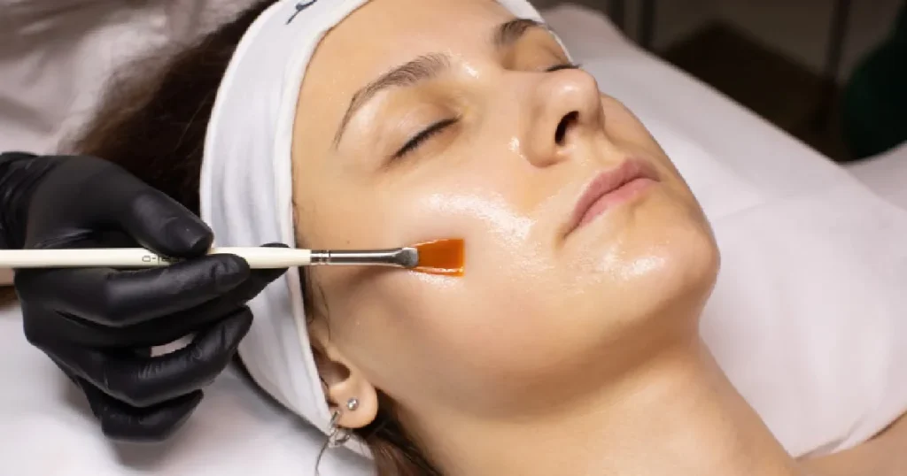 Women receiving Chemical Peel In St. Charles, IL
