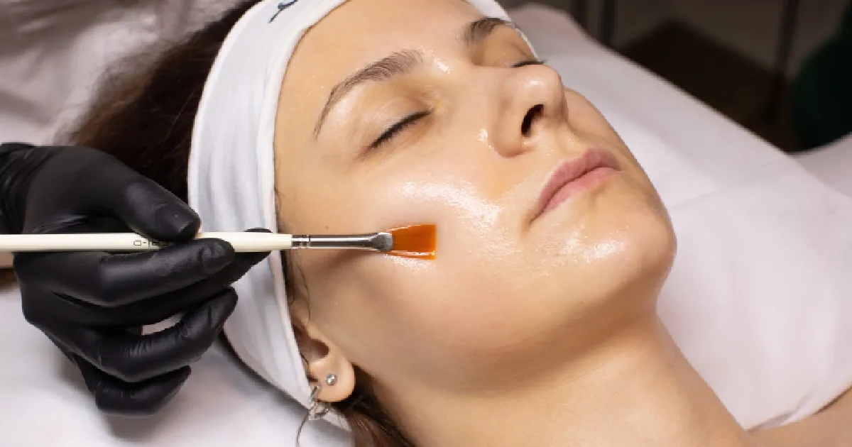 Women receiving Chemical Peel In St. Charles, IL